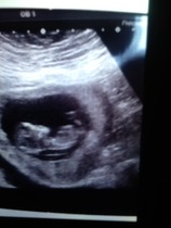 Boy or girl at 12 week scan?