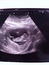 Baby just gender scan girl but looks like boy