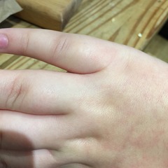 help with DD finger