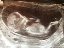 August 2016 (3) - scans fast approaching, teeny tiny bumps appearing, and sickness easing....we hope!