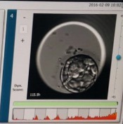 Forty and over trying for a first baby - join us here