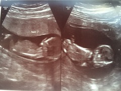August 2016 (3) - scans fast approaching, teeny tiny bumps appearing, and sickness easing....we hope!