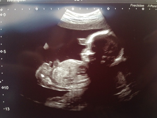 Thread #4 - TTC#1 the one where Stark joins the grads!!!!