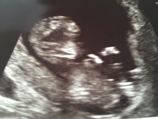 Thread #3 - TTC#1 Grads thread. No TMI is too much, no question too stupid!