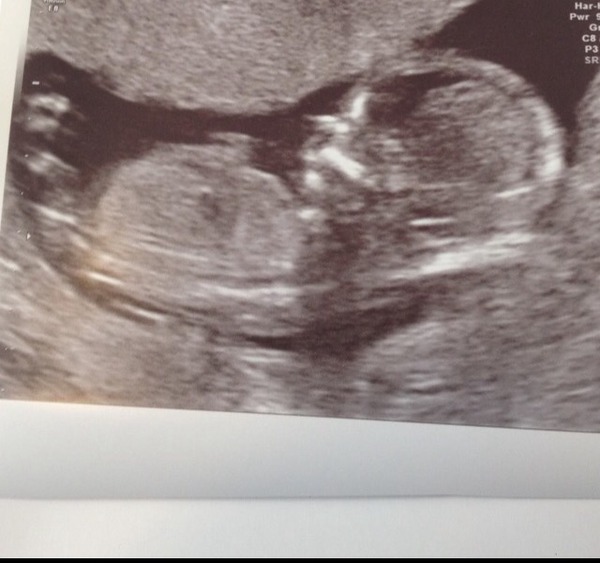 Boy or girl?? Help....I can't see it?!