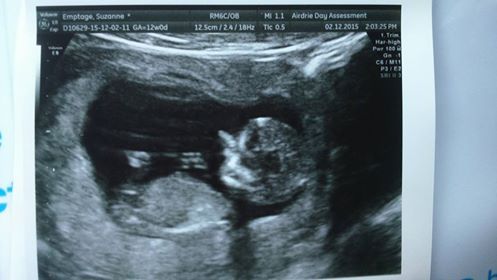 Guess the sex?