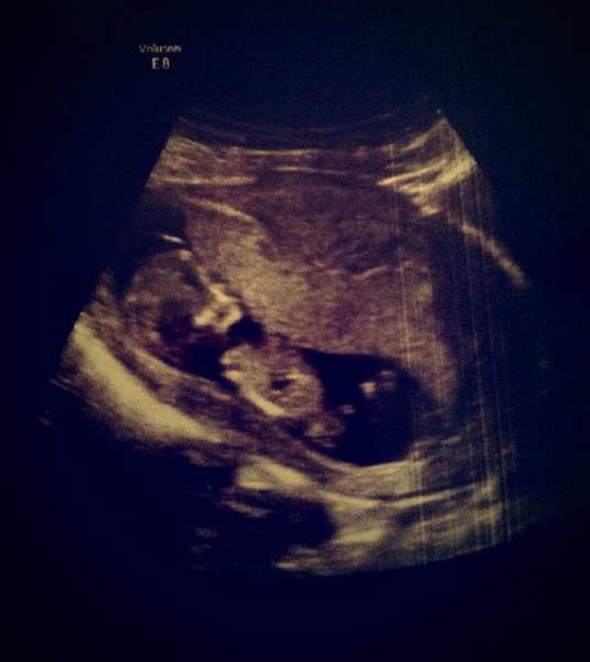 Boy or girl...wriggly, non compliant baby!
