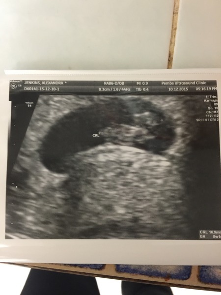 Scan at 8w - what can you see?
