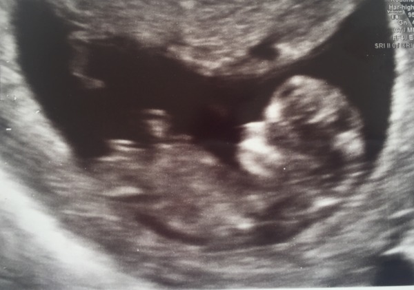 October 2016. Thread 3 - Booking In and Dating Scans!