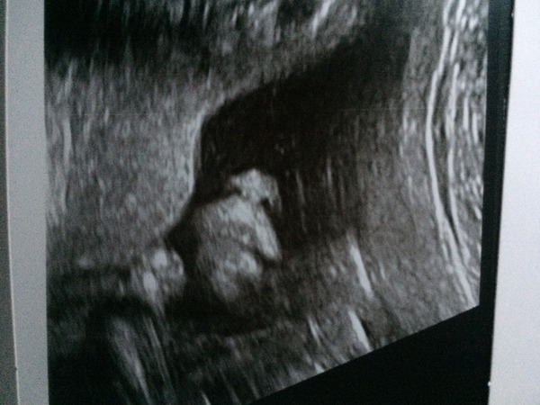 July 2016 (7) We're halfway to meeting our little bubs