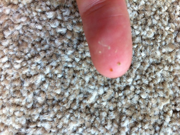 Possible worms? (Tmi alert pic)