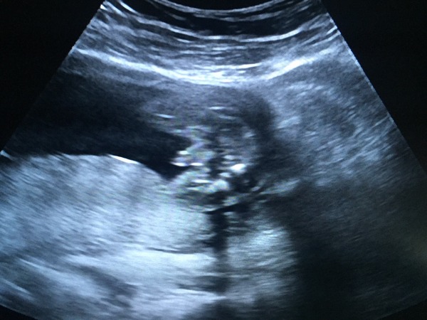Worried gender scan is wrong! Help!