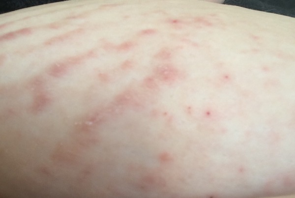 November 2016. Hoping for sticky ones!!!