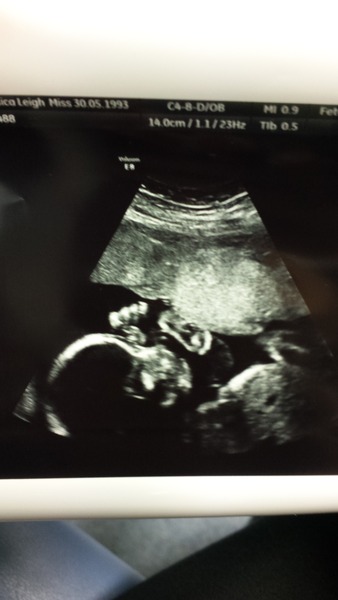 July 2016 (7) We're halfway to meeting our little bubs