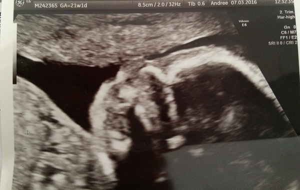 Anyone ttc baby #2 continued?