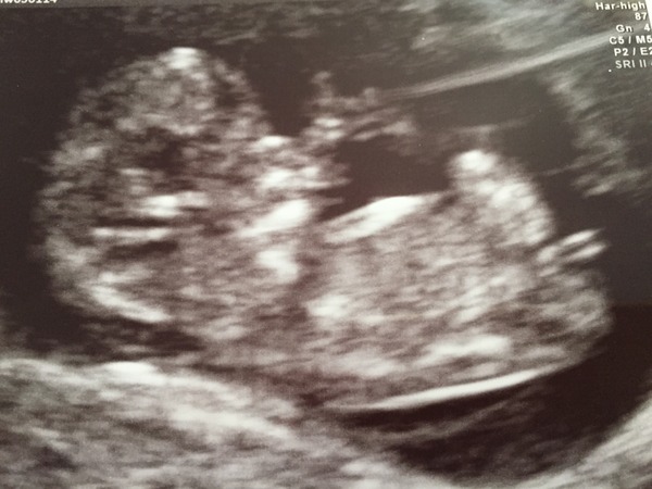 October 2016 bus #2 - getting our bfp's