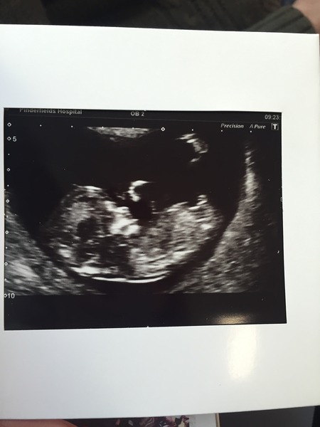First post 😁 Here's my scan 💕💙