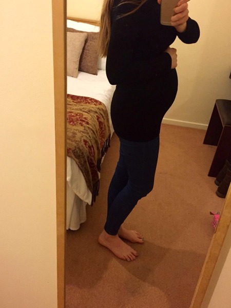 Concerned about size of bump
