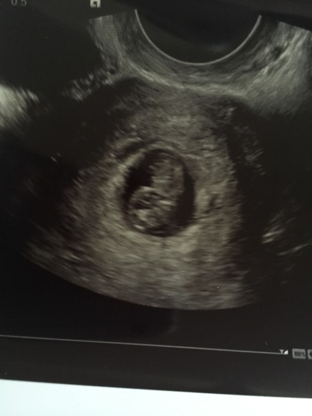 Staying posifrickentive- Thread 8 for ladies after mc