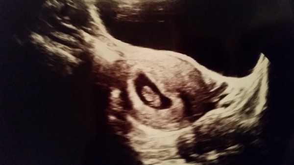 Thread #3 - TTC#1 Grads thread. No TMI is too much, no question too stupid!