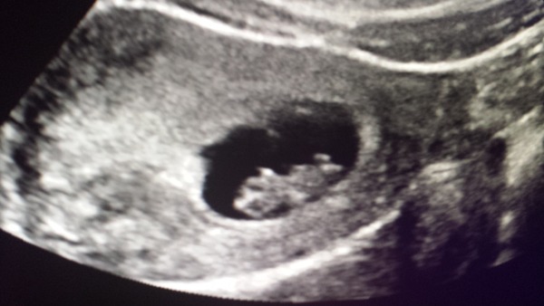 Thread #4 - TTC#1 the one where Stark joins the grads!!!!