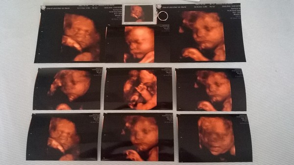 Staying posifrickentive- Thread 8 for ladies after mc