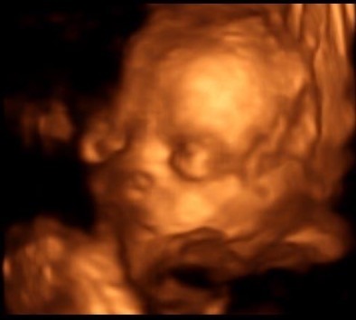 June 2016 #7 - We're still waiting for the second trimester "bloom" but healthy babies and stronger kicks all around!!