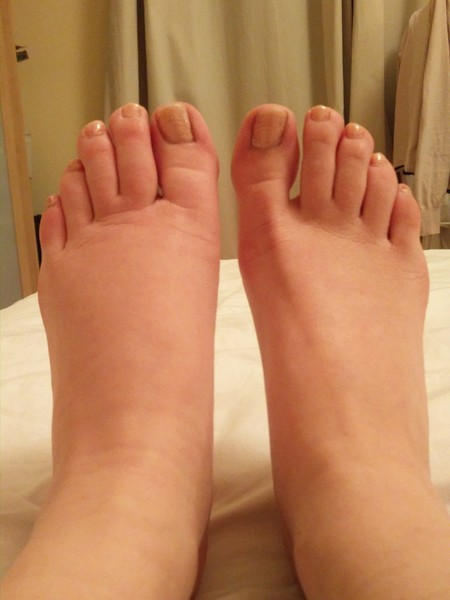 A "care to diagnose me?" thread