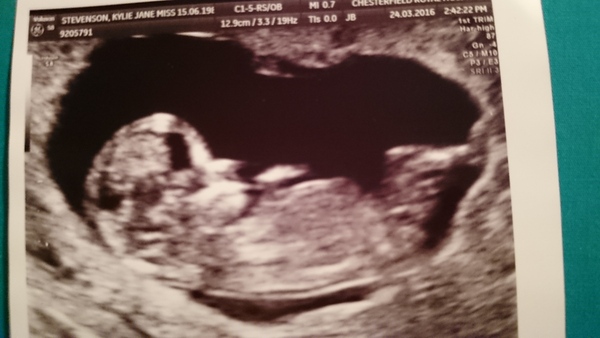 October 2016. Thread 3 - Booking In and Dating Scans!