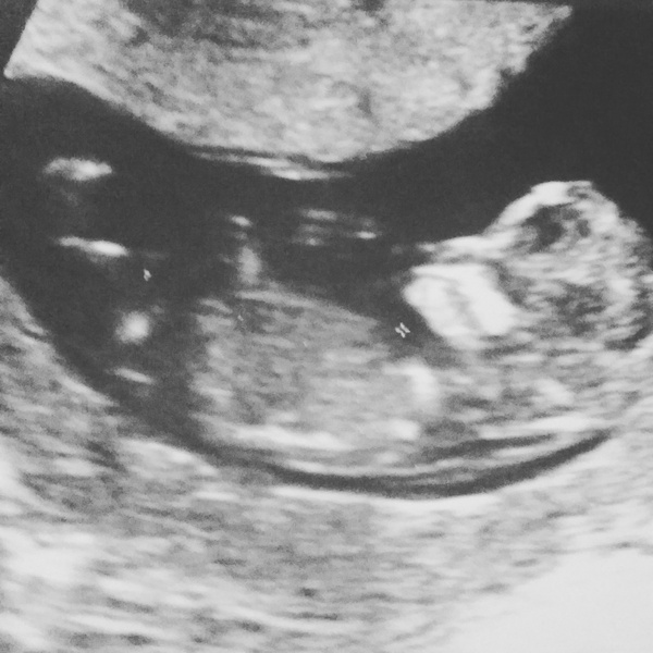 anyone guess gender 😊