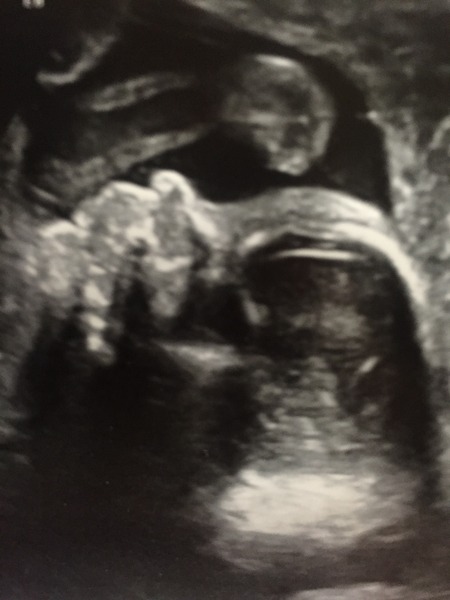 June 2016 #7 - We're still waiting for the second trimester "bloom" but healthy babies and stronger kicks all around!!