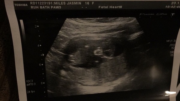 guess the gender!