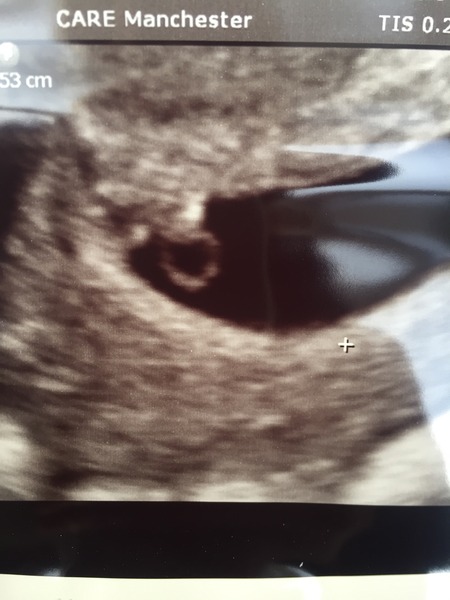 November 2016. Hoping for sticky ones!!!