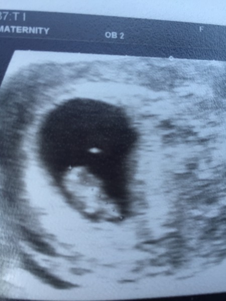 Thread #3 - TTC#1 Grads thread. No TMI is too much, no question too stupid!