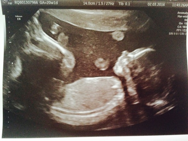 In awe of 20 week scan!