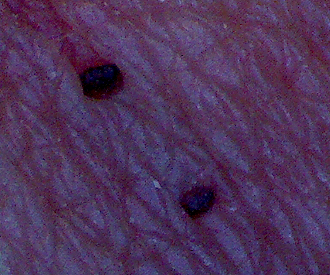Is there a dermatologist that knows what these spots are?