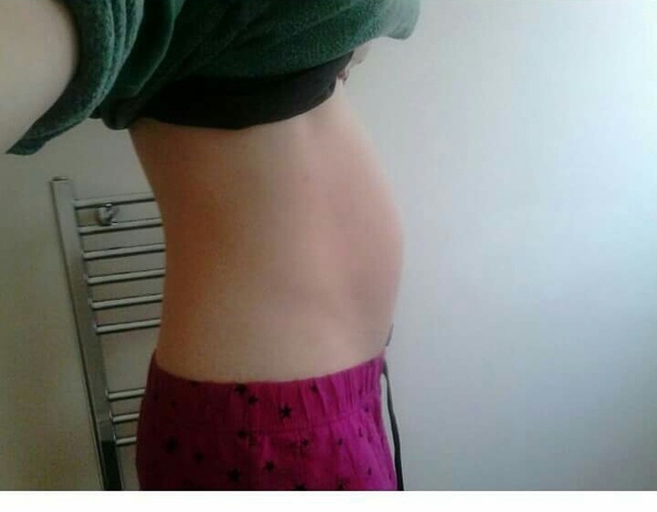 Paranoid about bump