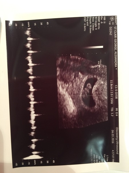 Staying posifrickentive- Thread 8 for ladies after mc