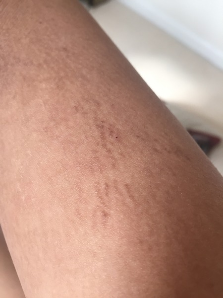 what on EARTH are these bumps?