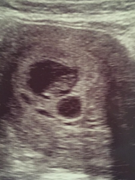 Staying posifrickentive- Thread 8 for ladies after mc