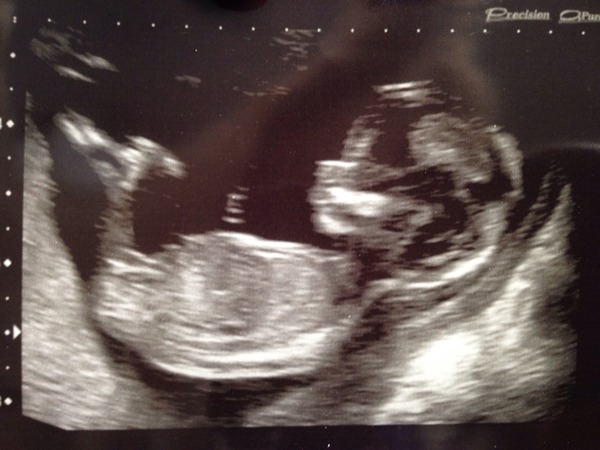 October 2016. Thread 3 - Booking In and Dating Scans!