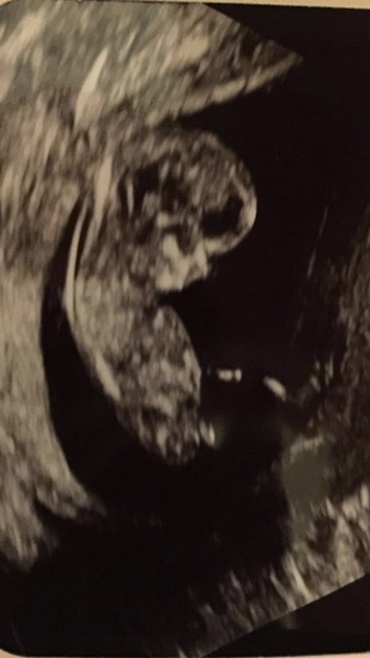 Thread #3 - TTC#1 Grads thread. No TMI is too much, no question too stupid!