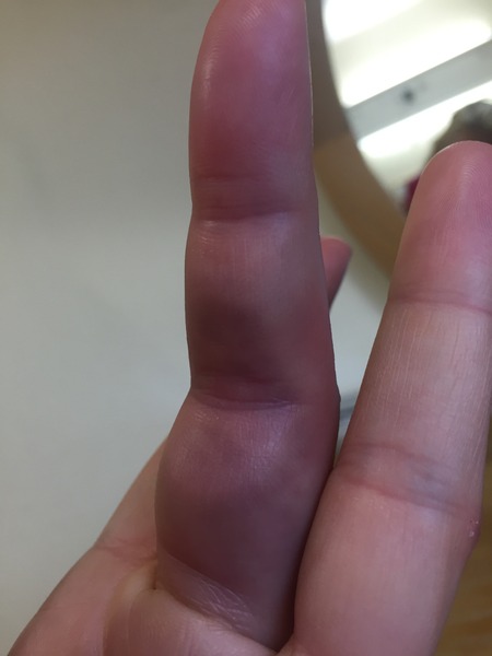 Anyone starting IVF? Join me (5)