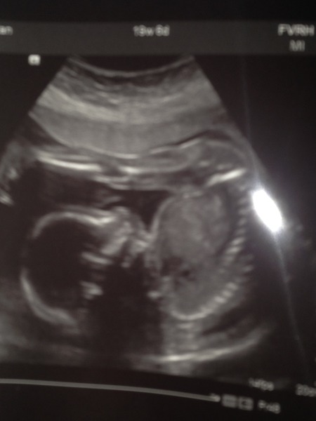 Anyone ttc baby #2 continued?