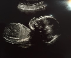 August 2016 number 4 - bumps popping and scans happening, we actually have babies!