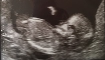 Nub theory boy or girl?!