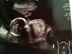 July 2016 (7) We're halfway to meeting our little bubs