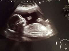 July 2016 (7) We're halfway to meeting our little bubs