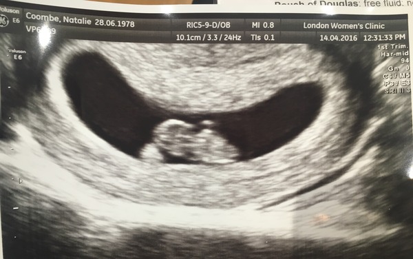 TTC through Donor IUI or Donor IVF or just undecided - all welcome!