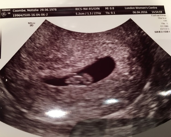 TTC through Donor IUI or Donor IVF or just undecided - all welcome!